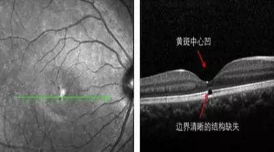 绿色激光笔的危害有多大（激光笔又双叒叕上热搜）(9)