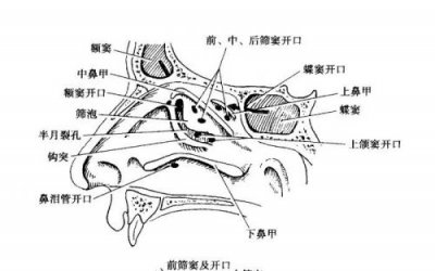 ​慢性筛窦炎是什么意思(慢性筛窦炎的症状及治疗)