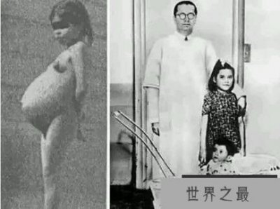 ​盘点世界上年龄最小的妈妈，秘鲁少女成最小（年仅5岁）