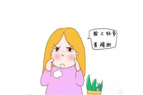 黄褐斑是怎么样形成的 黄褐斑是什么样子